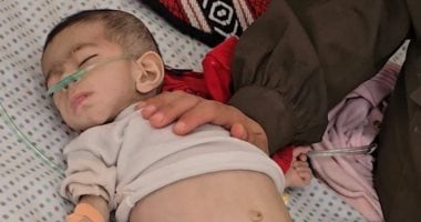 وفاة طفلة من غزة نتيجة المجاعة ترفع عدد الضحايا إلى 54 طفلًا