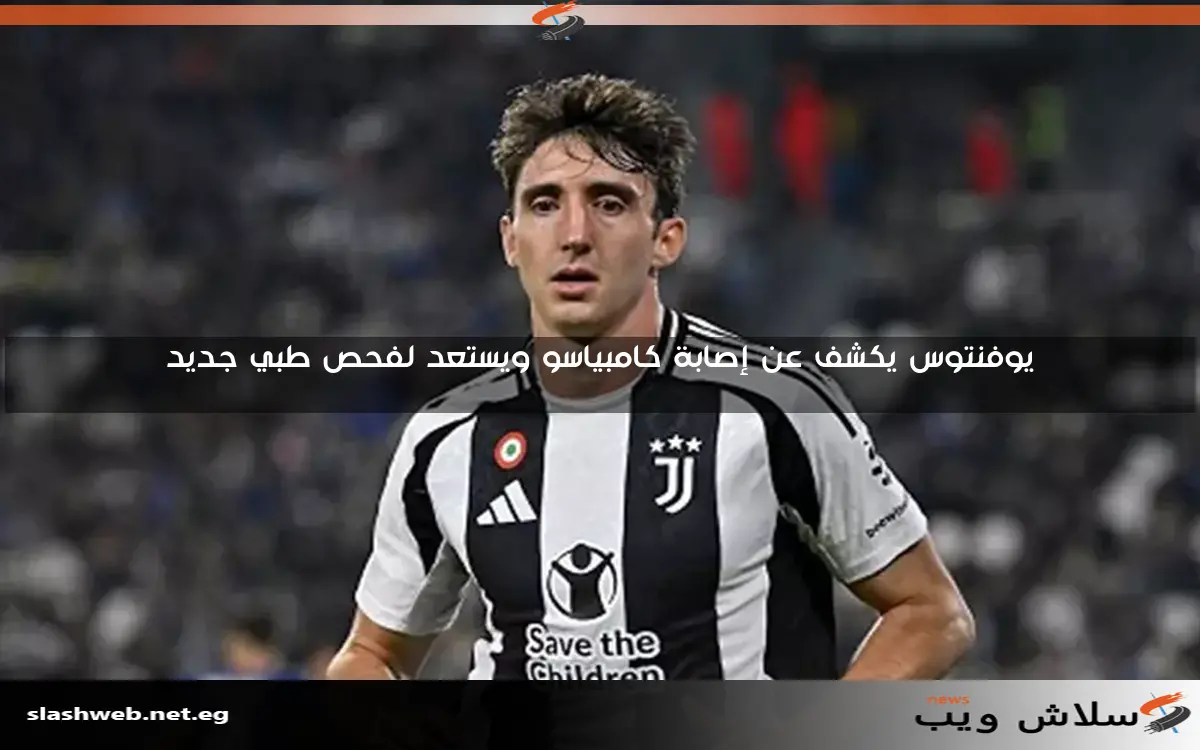 يوفنتوس يكشف عن إصابة كامبياسو ويستعد لفحص طبي جديد