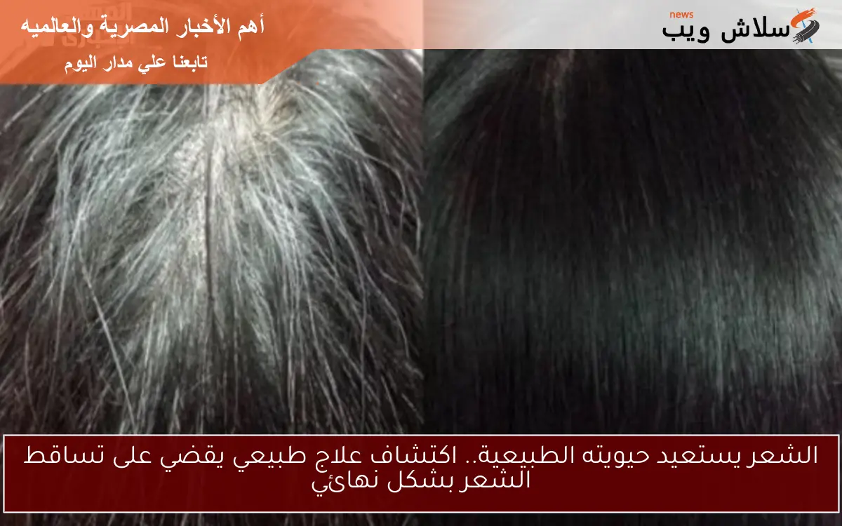الشعر يستعيد حيويته الطبيعية.. اكتشاف علاج طبيعي يقضي على تساقط الشعر بشكل نهائي