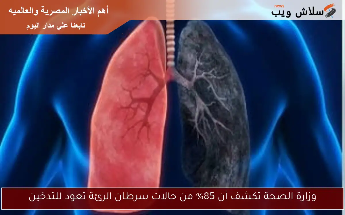 وزارة الصحة تكشف أن 85% من حالات سرطان الرئة تعود للتدخين