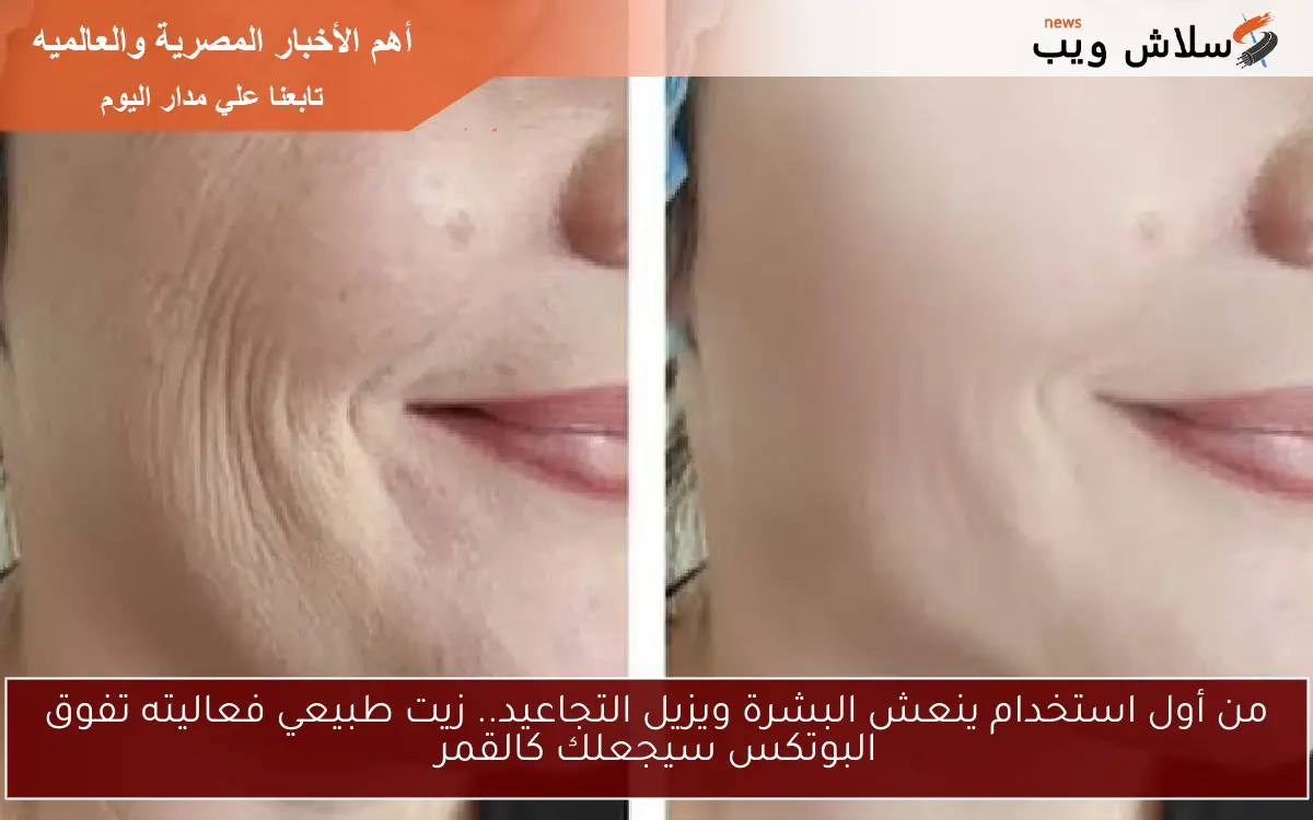 من أول استخدام ينعش البشرة ويزيل التجاعيد.. زيت طبيعي فعاليته تفوق البوتكس سيجعلك كالقمر