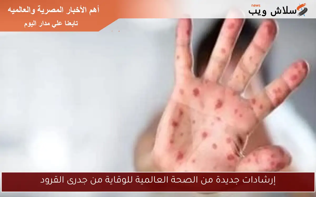 إرشادات جديدة من الصحة العالمية للوقاية من جدرى القرود