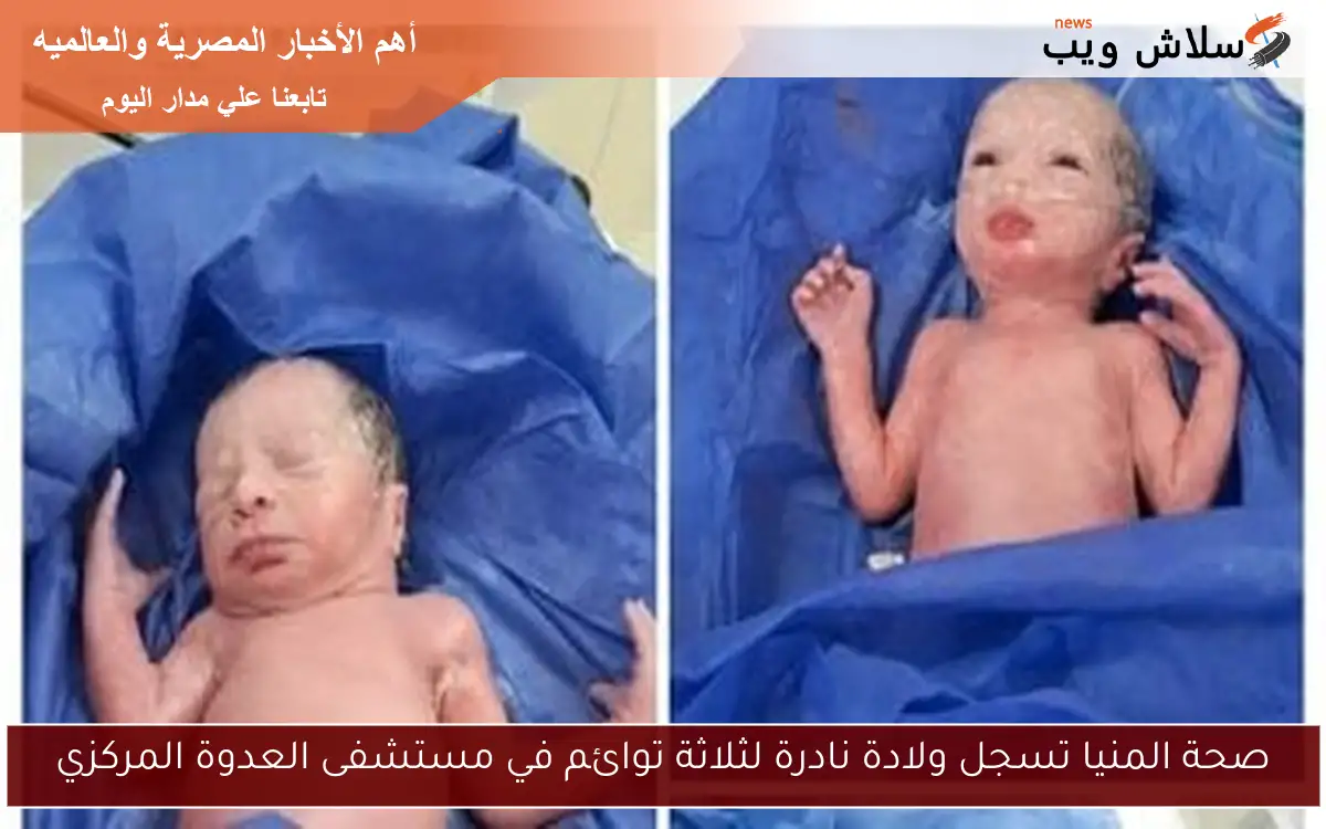 صحة المنيا تسجل ولادة نادرة لثلاثة توائم في مستشفى العدوة المركزي