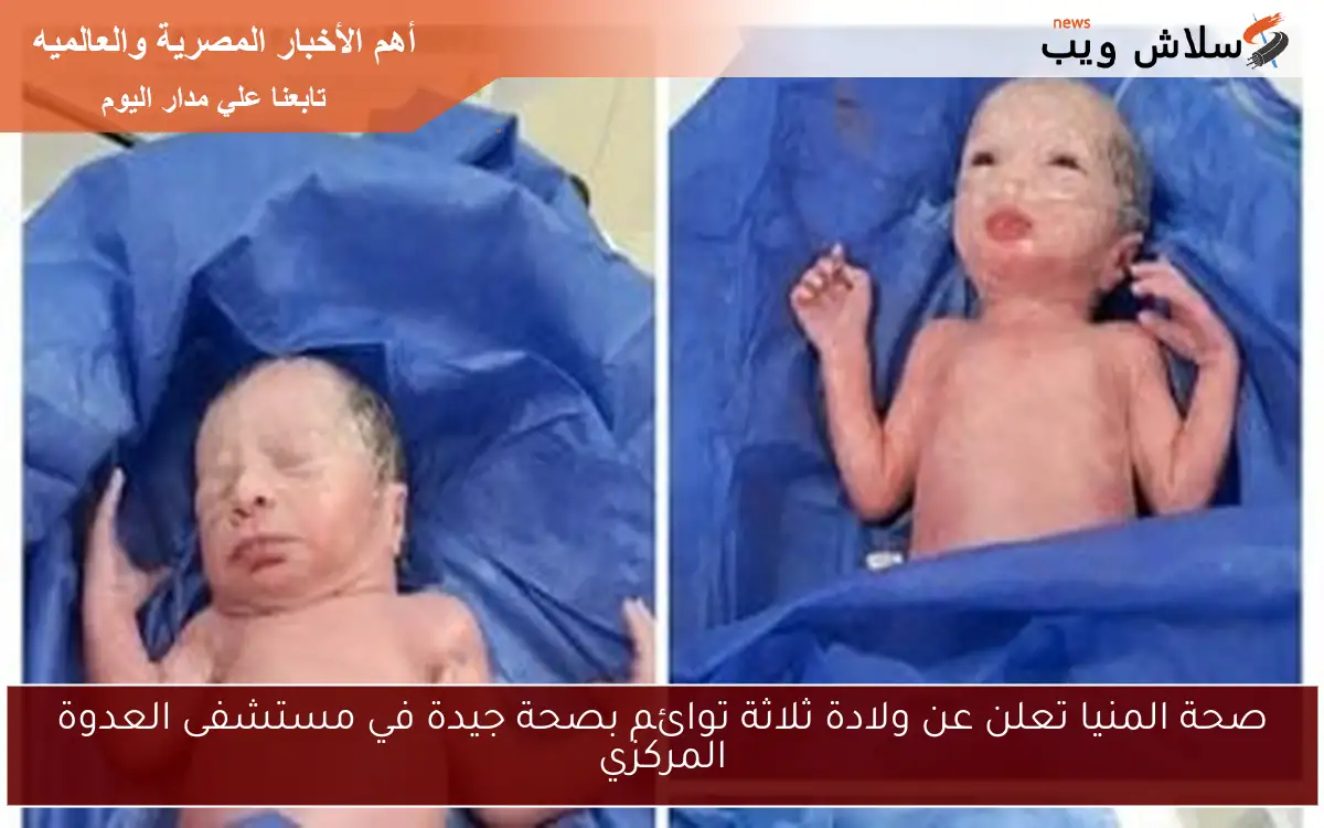 صحة المنيا تعلن عن ولادة ثلاثة توائم بصحة جيدة في مستشفى العدوة المركزي